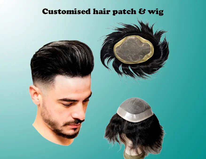 Customised Hair patch Service in noida MS Hair Fixing Clinic